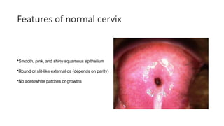Carcinoma cervix screening and prevention.pptx