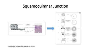 Squamoculmnar
Junction
Columnar Epithelium
Squamous Epithelium
 