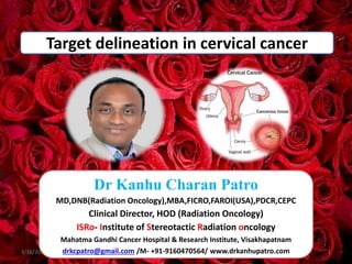 Target delineation in cervical cancer
3/16/2024 1
Dr Kanhu Charan Patro
MD,DNB(Radiation Oncology),MBA,FICRO,FAROI(USA),PDCR,CEPC
Clinical Director, HOD (Radiation Oncology)
ISRo- Institute of Stereotactic Radiation oncology
Mahatma Gandhi Cancer Hospital & Research Institute, Visakhapatnam
drkcpatro@gmail.com /M- +91-9160470564/ www.drkanhupatro.com
 