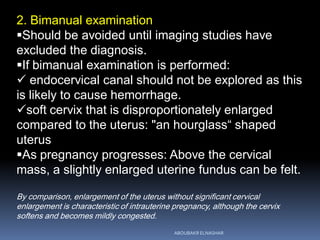 2. Bimanual examination
Should be avoided until imaging studies have
excluded the diagnosis.
If bimanual examination is performed:
 endocervical canal should not be explored as this
is likely to cause hemorrhage.
soft cervix that is disproportionately enlarged
compared to the uterus: "an hourglass“ shaped
uterus
As pregnancy progresses: Above the cervical
mass, a slightly enlarged uterine fundus can be felt.
By comparison, enlargement of the uterus without significant cervical
enlargement is characteristic of intrauterine pregnancy, although the cervix
softens and becomes mildly congested.
ABOUBAKR ELNASHAR
 