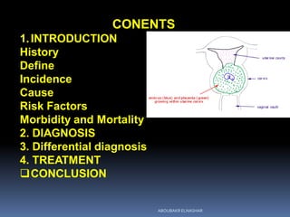 CONENTS
1.INTRODUCTION
History
Define
Incidence
Cause
Risk Factors
Morbidity and Mortality
2. DIAGNOSIS
3. Differential diagnosis
4. TREATMENT
CONCLUSION
ABOUBAKR ELNASHAR
 