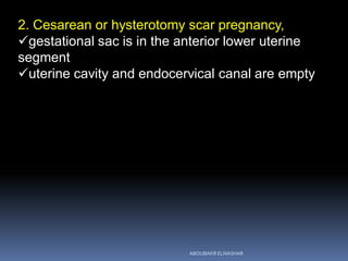 2. Cesarean or hysterotomy scar pregnancy,
gestational sac is in the anterior lower uterine
segment
uterine cavity and endocervical canal are empty
ABOUBAKR ELNASHAR
 