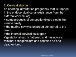 2. Cervical abortion:
an aborting intrauterine pregnancy that is trapped
in the endocervical canal {resistance from the
external cervical os}.
some products of conception/blood clot in the
uterine cavity
the uterine cavity is enlarged compared to the
cervix
the internal cervical os is open
gestational sac is flattened and has no or a
minimal echogenic rim and contains no or a
dead embryo
ABOUBAKR ELNASHAR
 