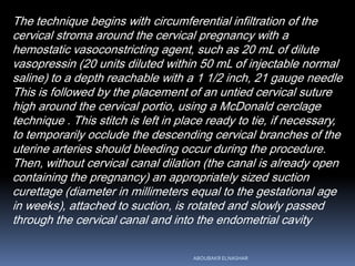 The technique begins with circumferential infiltration of the
cervical stroma around the cervical pregnancy with a
hemostatic vasoconstricting agent, such as 20 mL of dilute
vasopressin (20 units diluted within 50 mL of injectable normal
saline) to a depth reachable with a 1 1/2 inch, 21 gauge needle
This is followed by the placement of an untied cervical suture
high around the cervical portio, using a McDonald cerclage
technique . This stitch is left in place ready to tie, if necessary,
to temporarily occlude the descending cervical branches of the
uterine arteries should bleeding occur during the procedure.
Then, without cervical canal dilation (the canal is already open
containing the pregnancy) an appropriately sized suction
curettage (diameter in millimeters equal to the gestational age
in weeks), attached to suction, is rotated and slowly passed
through the cervical canal and into the endometrial cavity
ABOUBAKR ELNASHAR
 