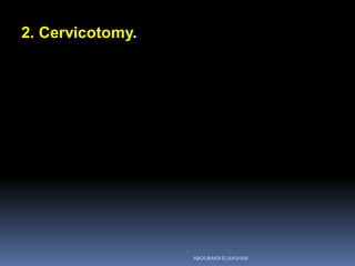 2. Cervicotomy.
ABOUBAKR ELNASHAR
 