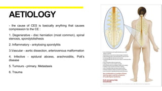 - the cause of CES is basically anything that causes
compression to the CE :
1. Degenerative - disc herniation (most common), spinal
stenosis, spondylolisthesis
2. Inflammatory - ankylosing spondylitis
3.Vascular - aortic dissection, arteriovenous malformation
4. Infective - epidural abcess, arachnoiditis, Pott’s
disease
5. Tumours - primary. Metastasis
6. Trauma
AETIOLOGY
 