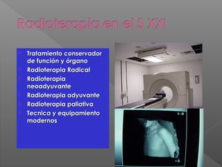  Tratamiento conservadorTratamiento conservador
de función y órganode función y órgano
 Radioterapia RadicalRadioterapia Radical
 RadioterapiaRadioterapia
neoadyuvanteneoadyuvante
 Radioterapia adyuvanteRadioterapia adyuvante
 Radioterapia paliativaRadioterapia paliativa
 Tecnica y equipamientoTecnica y equipamiento
modernosmodernos
 