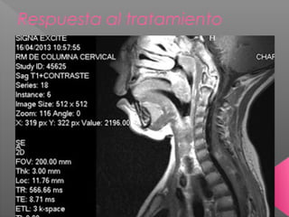 Respuesta al tratamiento
 