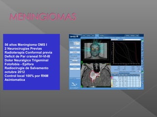 56 años Meningioma OMS I
2 Neurocirugìas Previas
Radioterapia Conformal previa
Deficit de Par craneal IV-VI-III
Dolor Neuralgico Trigeminal
Fotofobia - Epifora
Radiocirugia de Salvamento
octubre 2012
Control local 100% por RNM
Asintomatica
 