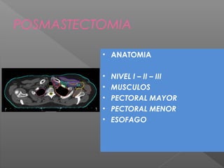 POSMASTECTOMIA
• ANATOMIA
• NIVEL I – II – III
• MUSCULOS
• PECTORAL MAYOR
• PECTORAL MENOR
• ESOFAGO
 