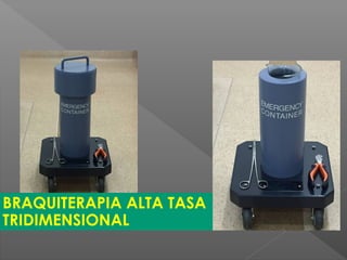 BRAQUITERAPIA ALTA TASA
TRIDIMENSIONAL
 