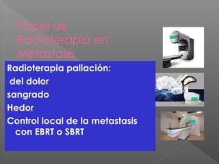 Papel de
Radioterapia en
Metastasis
Radioterapia paliación:
del dolor
sangrado
Hedor
Control local de la metastasis
con EBRT o SBRT
 