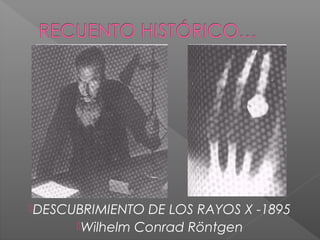 DESCUBRIMIENTO DE LOS RAYOS X -1895
Wilhelm Conrad Röntgen
 
