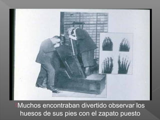 Muchos encontraban divertido observar los
huesos de sus pies con el zapato puesto
 