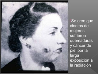Se cree que
cientos de
mujeres
sufrieron
quemaduras
y cáncer de
piel por la
larga
exposición a
la radiación
 