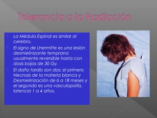  La Médula Espinal es similar al
cerebro.
 El signo de Lhermitte es una lesión
desmielinizante temprana
usualmente reversible hasta con
dosis bajas de 30 Gy.
 El daño tardío son dos; el primero
Necrosis de la materia blanca y
Desmielinización de 6 a 18 meses y
el segundo es una vasculopatía,
latencia 1 a 4 años.
 