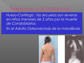  Hueso-Cartílago : las secuelas son severas
en niños menores de 2 años por la muerte
de Condoblastos.
 En el Adulto Osteonecrosis de la mandíbula
 