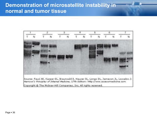 Page  36
Demonstration of microsatellite instability in
normal and tumor tissue
 