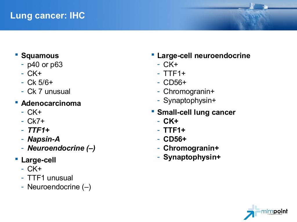 CES 2016 02 - Lung Cancer