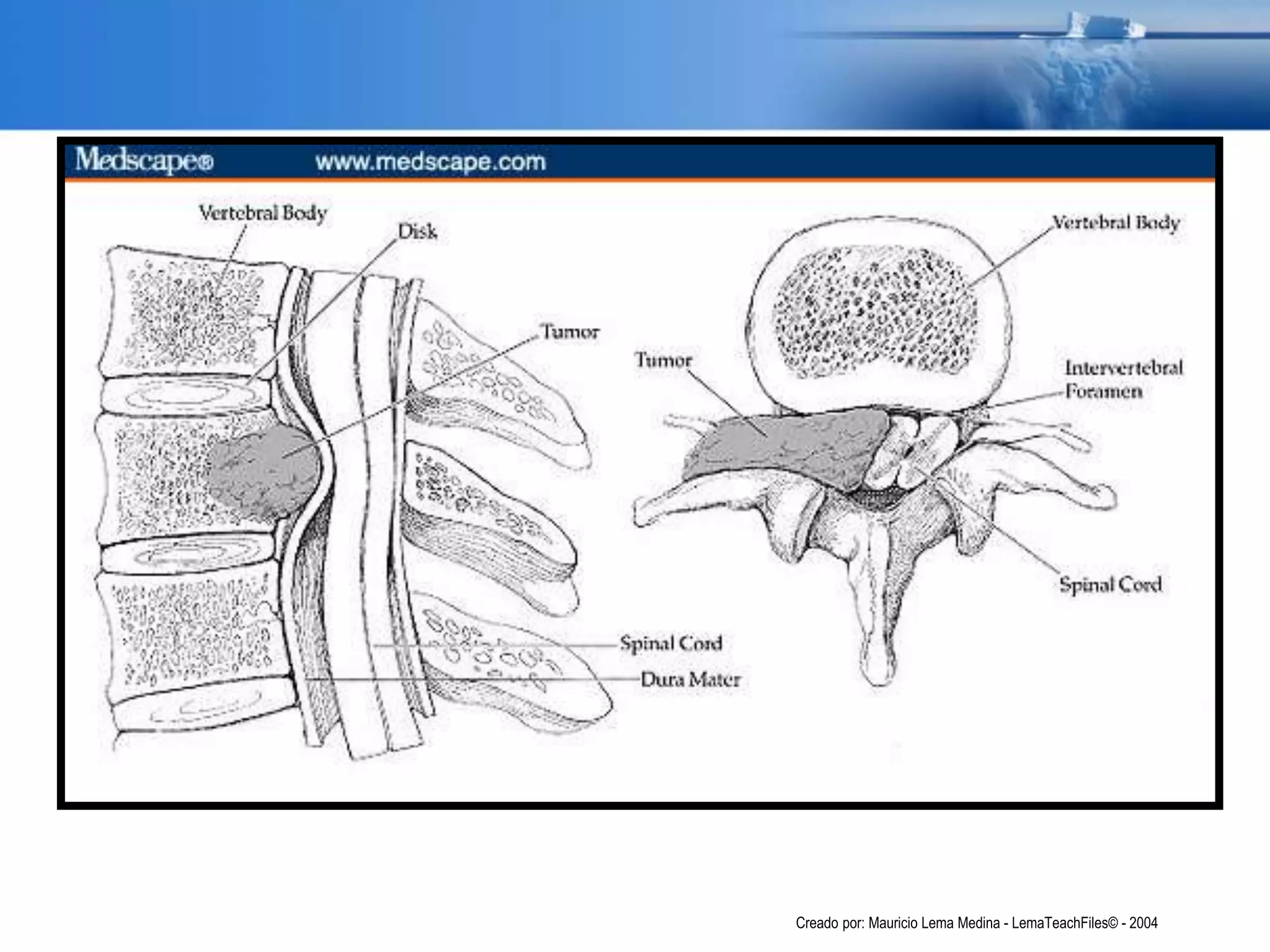 Creado por: Mauricio Lema Medina - LemaTeachFiles© - 2004
 