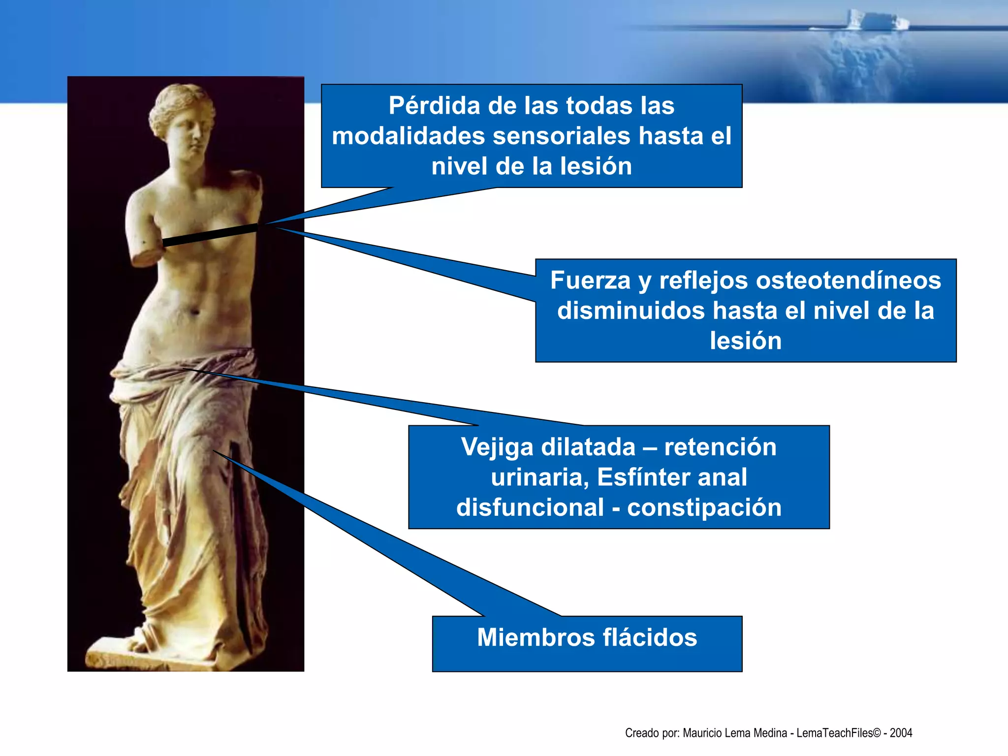 Pérdida de las todas las
modalidades sensoriales hasta el
nivel de la lesión
Fuerza y reflejos osteotendíneos
disminuidos hasta el nivel de la
lesión
Miembros flácidos
Vejiga dilatada – retención
urinaria, Esfínter anal
disfuncional - constipación
Creado por: Mauricio Lema Medina - LemaTeachFiles© - 2004
 