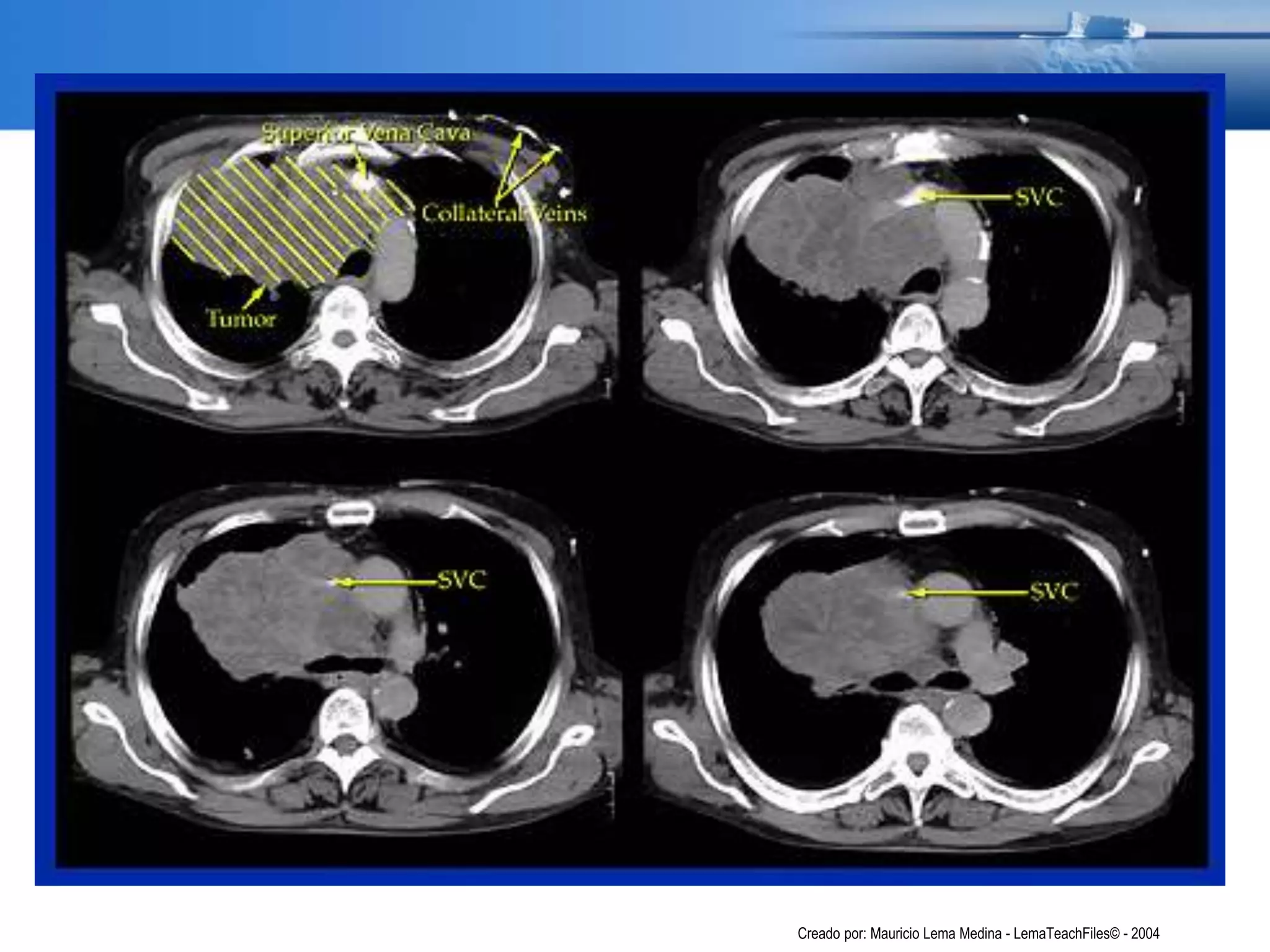 Creado por: Mauricio Lema Medina - LemaTeachFiles© - 2004
 