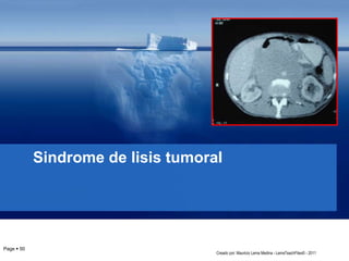 Sindrome de lisis tumoral
Page  50
Creado por: Mauricio Lema Medina - LemaTeachFiles© - 2011
 