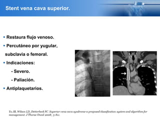 Stent vena cava superior.
 Restaura flujo venoso.
 Percutáneo por yugular,
subclavia o femoral.
 Indicaciones:
- Severo.
- Paliación.
 Antiplaquetarios.
 