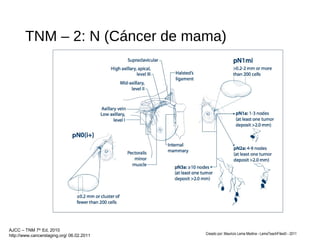 TNM – 2: N (Cáncer de mama)
Creado por: Mauricio Lema Medina - LemaTeachFiles© - 2011
AJCC – TNM 7th
Ed, 2010
http://www.cancerstaging.org/ 06.02.2011
 