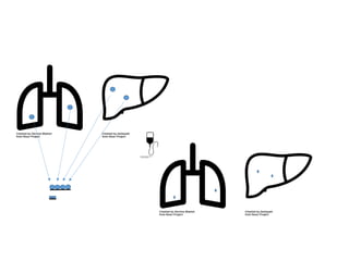 RECIST: Response Evaluation Criteria In Solid Tumors
Change in the sum of the longest diameters
↑20% (or new lesion): Progressive disease
↓30%: partial response (PR)
↓100%: unconfirmed complete response (uCR)
↓100% + Negative biopsy: complete response (CR)
 