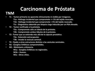 Carcinoma de Próstata
TNM
• T1 - Tumor primario no aparente clínicamente ni visible por imágenes.
T1a - Hallazgo incidental que compromete <= 5% del tejido resecado.
T1b - Hallazgo incidental que compromete > 5% del tejido resecado.
T1c - Diagnóstico obtenido por biopsia ciega inducida por un PSA elevado.
• T2 - Tumor confinado a la próstata.
T2a - Compromete sólo un lóbulo de la próstata.
T2b - Compremete ambos lóbulos de la próstata.
• T3 - Tumor que se extiende más allá de la cápsula prostática.
T3a - Extensión extracapsular.
T3b - Invade la vesícula seminal.
• T4 - Fijado a otras estructuras distinto a las vesículas seminales.
• N1 - Ganglios linfáticos comprometidos.
• M1 - Metástasis a distancia.
M1a - Ganglios linfáticos no regionales.
M1b – Huesos.
M1c - Otros sitios.
 