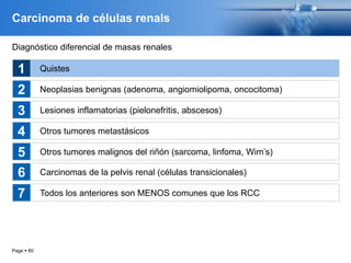 Page  80
Carcinoma de células renals
Diagnóstico diferencial de masas renales
Quistes
Neoplasias benignas (adenoma, angiomiolipoma, oncocitoma)
Lesiones inflamatorias (pielonefritis, abscesos)
Otros tumores metastásicos
Otros tumores malignos del riñón (sarcoma, linfoma, Wim’s)
1
2
3
4
5
Carcinomas de la pelvis renal (células transicionales)
Todos los anteriores son MENOS comunes que los RCC
6
7
 