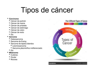 Tipos de cáncer
• Carcinoma
• Cáncer de pulmón
• Cáncer de mama
• Cáncer de próstata
• Cáncer de estómago
• Cáncer de colon
• Cáncer de recto
• Etc
• Sarcoma
• Osteosarcoma
• Sarcoma de Ewing
• Sarcoma de tejidos blandos
• Leiomiosarcoma
• Sarcoma pleomórfico indiferenciado
• Etc
• Melanoma
• Cutáneo
• Ocular
• Mucosa
 