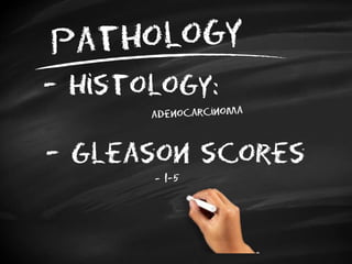 - histology:
- Gleason scores
 
