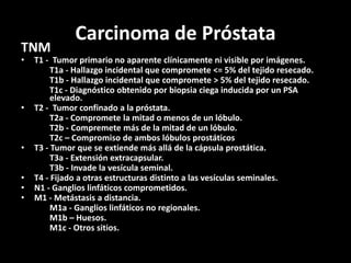 Carcinoma de Próstata
TNM
• T1 - Tumor primario no aparente clínicamente ni visible por imágenes.
T1a - Hallazgo incidental que compromete <= 5% del tejido resecado.
T1b - Hallazgo incidental que compromete > 5% del tejido resecado.
T1c - Diagnóstico obtenido por biopsia ciega inducida por un PSA
elevado.
• T2 - Tumor confinado a la próstata.
T2a - Compromete la mitad o menos de un lóbulo.
T2b - Compremete más de la mitad de un lóbulo.
T2c – Compromiso de ambos lóbulos prostáticos
• T3 - Tumor que se extiende más allá de la cápsula prostática.
T3a - Extensión extracapsular.
T3b - Invade la vesícula seminal.
• T4 - Fijado a otras estructuras distinto a las vesículas seminales.
• N1 - Ganglios linfáticos comprometidos.
• M1 - Metástasis a distancia.
M1a - Ganglios linfáticos no regionales.
M1b – Huesos.
M1c - Otros sitios.
 