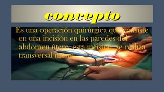 concepto
Es una operación quirúrgica que consiste
en una incisión en las paredes del
abdomen útero, esta incisión se realiza
transversal mente.