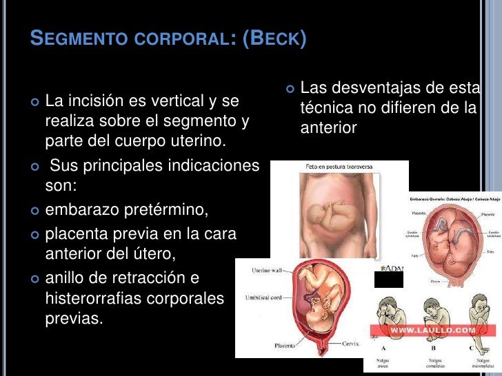 Cesara y tipos de cesareas indicaciones y contraindicaciones
