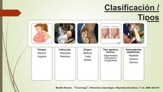Clasificación /
Tipos
Tiempo:
Electiva
Urgente
Indicación:
Absolutas
Relativas
Origen:
Materno
Fetal
Mixtas
Tipo apertura
uterina:
Segmentaria
transversa /
longitudinal
Antecedentes
obstétricos:
Repetida
Iterativa
Electiva
Bonilla Musoles. “Tococirugía”. Obstetricia, Ginecología y Reproducción básicas. 3ª ed. 2008. 602:615
 