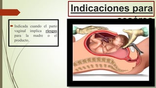 Indicaciones para
cesárea Indicada cuando el parto
vaginal implica riesgos
para la madre o el
producto.
 