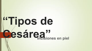 “Tipos de
Cesárea”Incisiones en piel
 