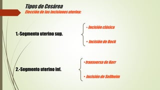 Tipos de Cesárea
Elección de las incisiones uterina:
1.-Segmento uterino sup.
2.-Segmento uterino inf.
• Incisión clásica
• Incisión de Beck
•transversa de Kerr
• Incisión de Sellheim
 