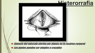 Histerorrafia
Síntesis del músculo uterino por planos en la cesárea corporal
Los puntos pueden ser simples o cruzados
 