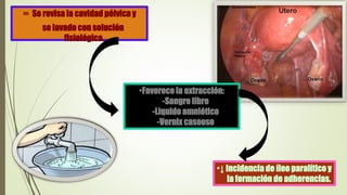  Se revisa la cavidad pélvica y
se lavado con solución
fisiológica.
•Favorece la extracción:
-Sangre libre
-Liquido amniótico
-Vernix caseoso
•↓ Incidencia de íleo paralítico y
la formación de adherencias.
 