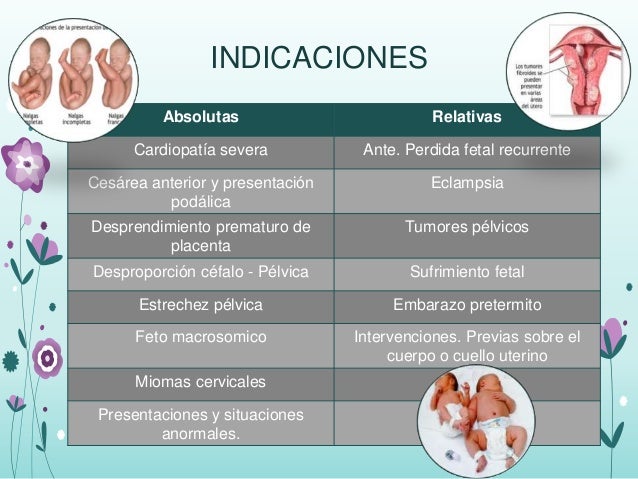 Cesarea diapositivas