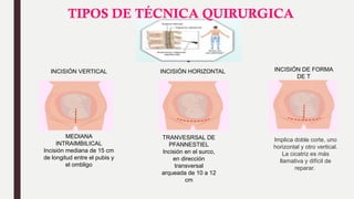 CESAREA DIAPOSITIVAS en power point.pptx