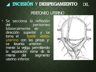 • Se secciona la reflexión
del peritoneo
bilateralmente en
dirección superior y se
toma el borde vesico-
uterino con las pinzas y
se levanta anterior-
mente la vejiga, permitiendo
la separación roma d
e la
misma del segmento
uterino inferior
.
◢ INCISIÓN Y DESPEGAMIENTO DEL
PERITONEO UTERINO
 