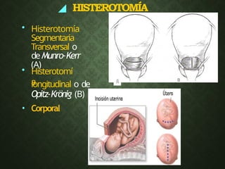 ◢ HISTEROTOMÍA
• Histerotomía
Segmentaria
Transversal o
deMunro-Kerr
(A)
• Histerotomí
a
longitudinal o de
Opitz-Krönig (B)
• Corporal
 