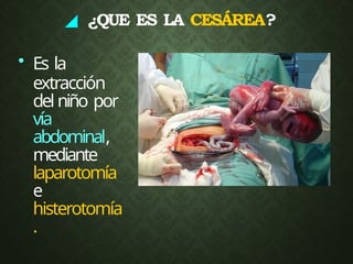 ◢ ¿QUE ES LA CESÁREA?
• Es la
extracción
del niño por
vía
abdominal,
mediante
laparotomía
e
histerotomía
.
 