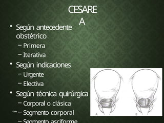 CESARE
A
C
e
s
á
r
e
a
s
• Según antecedente
obstétrico
– Primera
– Iterativa
• Según indicaciones
– Urgente
– Electiva
• Según técnica quirúrgica
– Corporal o clásica
– Segmento corporal
–
 