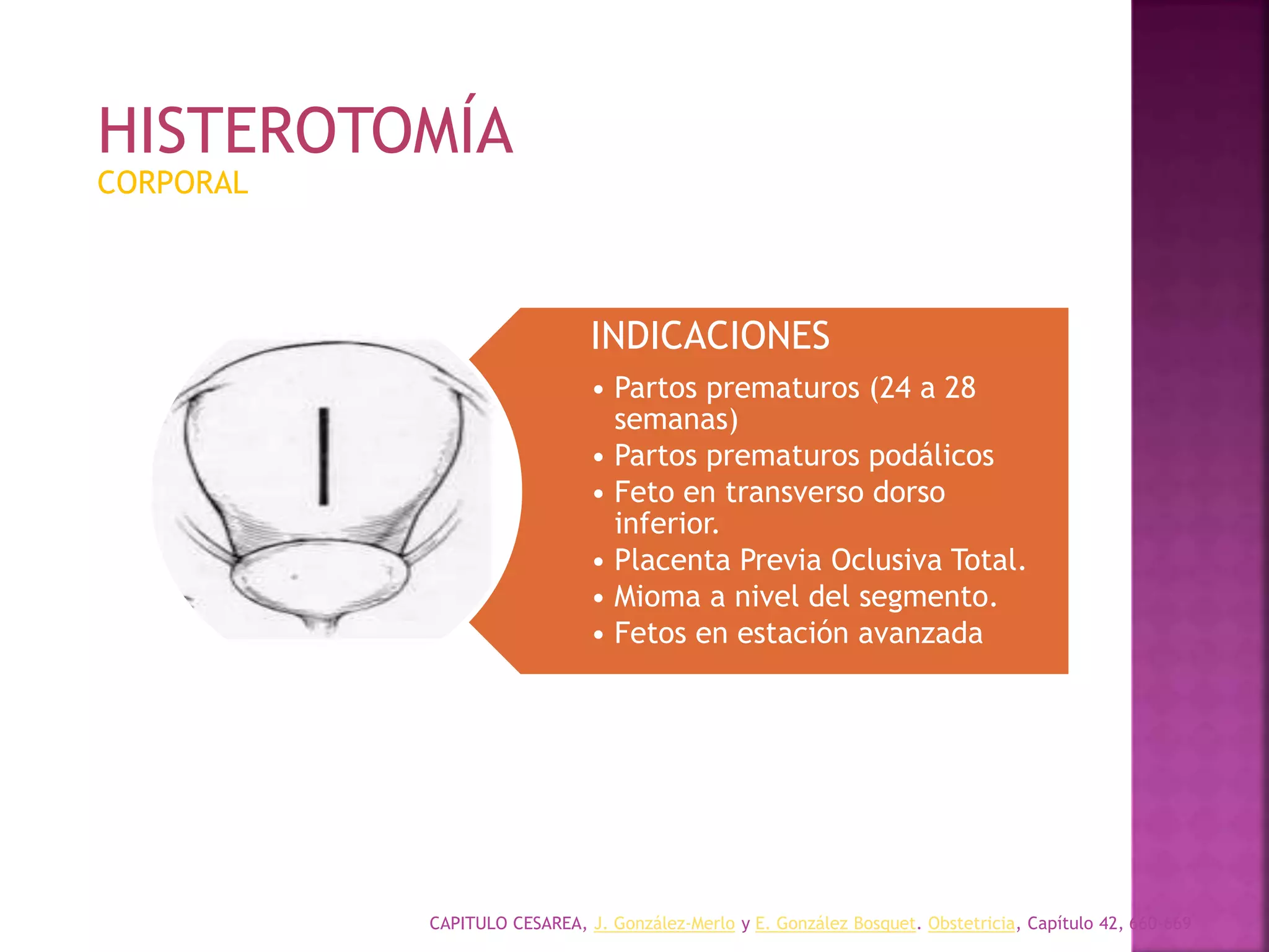 CAPITULO CESAREA, J. González-Merlo y E. González Bosquet. Obstetricia, Capítulo 42, 660-669
CORPORAL
INDICACIONES
• Partos prematuros (24 a 28
semanas)
• Partos prematuros podálicos
• Feto en transverso dorso
inferior.
• Placenta Previa Oclusiva Total.
• Mioma a nivel del segmento.
• Fetos en estación avanzada
HISTEROTOMÍA
 
